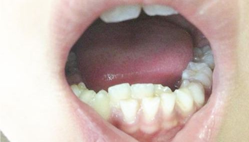 兔子牙和鲨鱼牙在风水上究竟有何神秘作用？