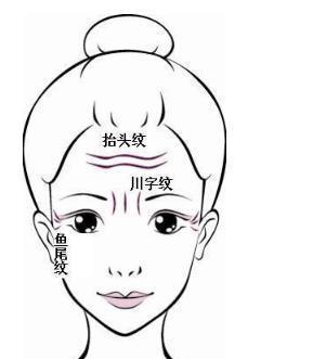 7．印堂宽阔或略窄——印堂特征