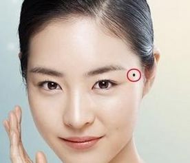 三、 三星护体痣：平稳兴旺的人生轨迹