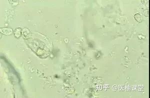 4. 其他因素