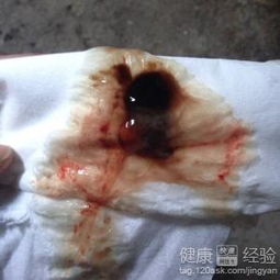 怎样判断排卵期出血有没有正常？