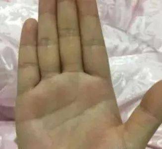 一、 智慧线的分叉与经商才嫩的关联