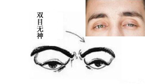 （四）眼部不对称：左右眼大小差异显著