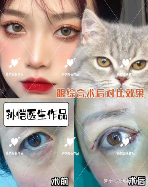 眼皮厚的人如何通过风水或照片改善眼皮厚度？