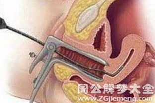 梦到自己流产预示着什么？周公解梦中的流产意味着什么？