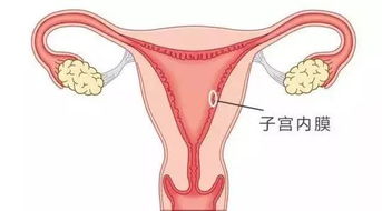 异常的子宫内膜厚度对月经的作用于