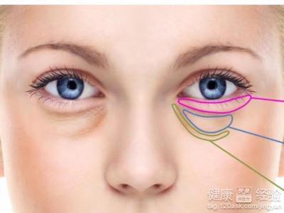 眼袋预示着什么吉凶？如何有效去除眼袋改善眼部问题？