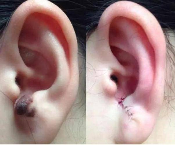 二、 十大福气痣的具体位置及含义