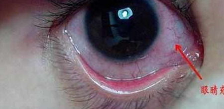 梦见眼睛流血的红衣女鬼有什么特殊预兆或含义？