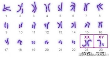 了解染色体检查的十分沉关键性