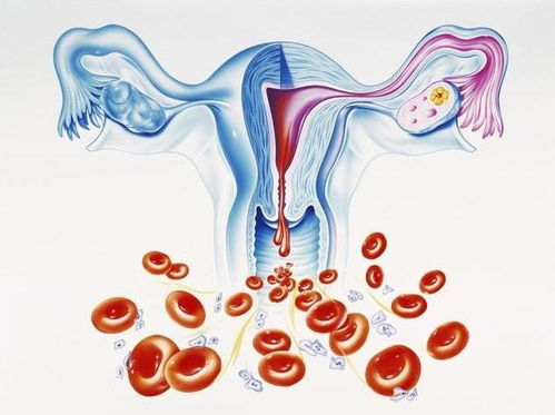 四、 更多囊卵巢综合征（PCOS）— 一个悄然逼近的较小怪兽