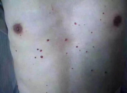 梦见盆里血水流出来是什么征兆或含义？