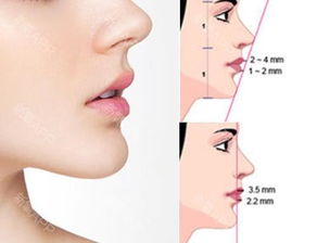 下巴下方长毛，佛下巴一根毛，是何原因？