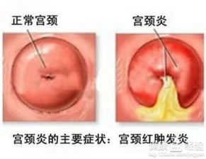 二、 中药医治：传统方式的救命稻草