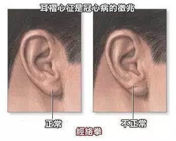 1.1 垂珠在面相学中的象征意义