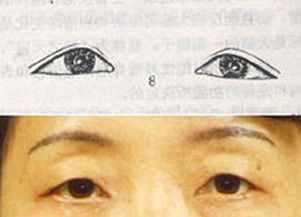 二、 辨识龙凤眼面相的方法论