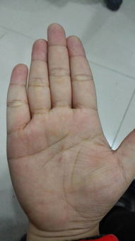 六、 案例分析：从掌纹到命运转折