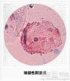 常见误区一：只要吃药就能彻底解决？