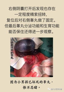a) 梦中秃顶：不祥预兆还是自我成较长信号？