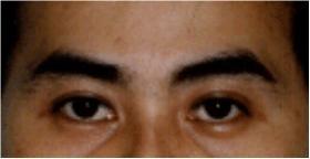1. 两眉间距较窄——聪慧却自闭