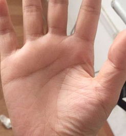 蛇眼手相和蛇眼人图片，有什么特别之处吗？