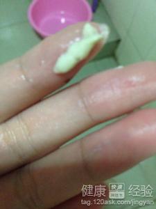 1、白带自愈这事儿到底有更多靠谱？