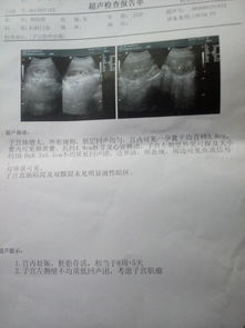 怎样应对左边子宫隐痛？