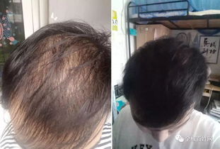 五、 情绪波动与行为冲动之间的相互作用机制