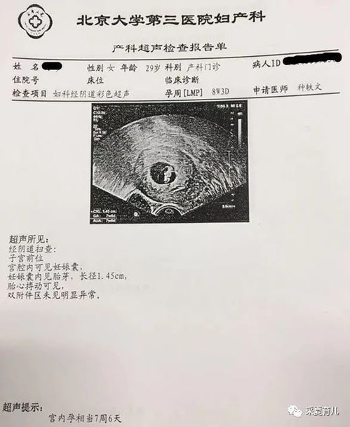 孕早期超声检查：揭秘胎心胎芽的“保密”