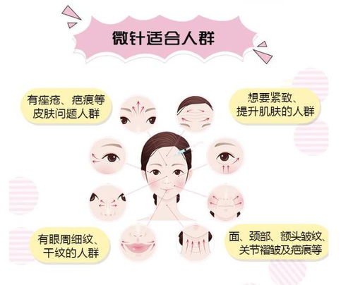 面部各部位之六爻解读