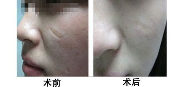 三、 平安性与有效性的综合评判