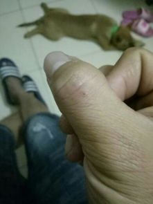 梦见被抢劫刀伤出血是什么预兆？