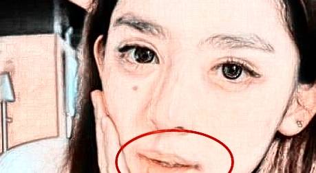 一、  生物学视角下的美人尖：遗传机制与形态学解析