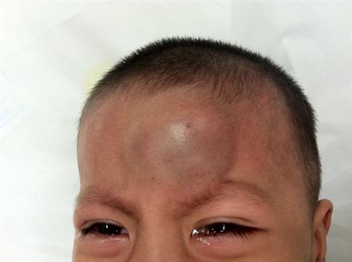 小孩额头凹进去2厘米代表聪明吗？面相解读有依据吗？