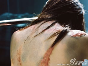 2. 破相与疤痕的风水寓意