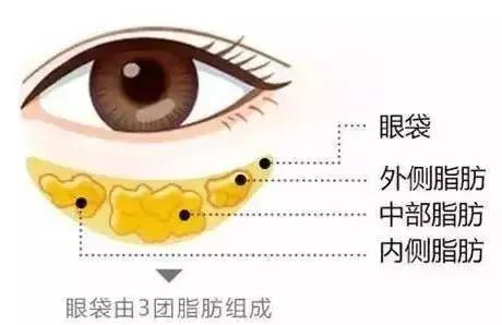 眼袋塌陷对家居风水有影响吗？