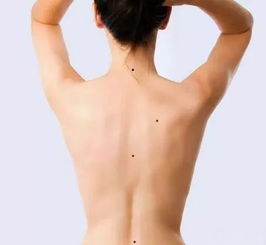 案例一：张先生——中线痣与事业巅峰