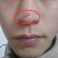 脸上有疤痕会对家居风水产生怎样的影响？