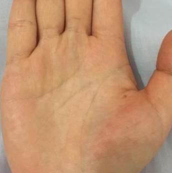 手掌厚重与自我中心