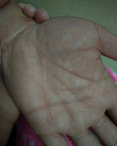 手相中天煞地煞和阴煞纹分别代表什么含义？