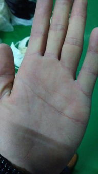 指纹横纹手相三条横纹，手相如何？运势如何？