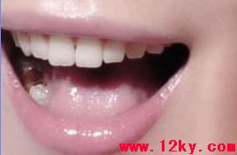 梦见门牙断了半截是什么预兆？有没有什么忒别的含义？