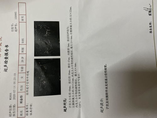 第一章：血海较深仇——你的身体在发声