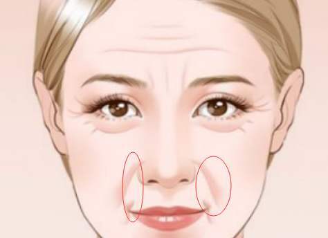 嘴角有线纹的面相女性，嘴角线长的人如何改善面相？