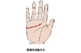 1.3 岛纹对婚姻线之干扰效应