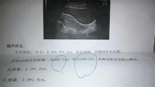 提升移植成功率的方法有哪些？