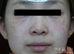 四、 疾病因素：自身免疫疾病与内分泌失调