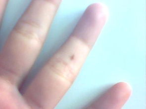 后天形成与健康考量