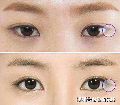 眼部特征与情感状态