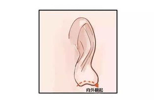 2.1 耳垂的大小与储蓄嫩力：一种隐喻性的解读